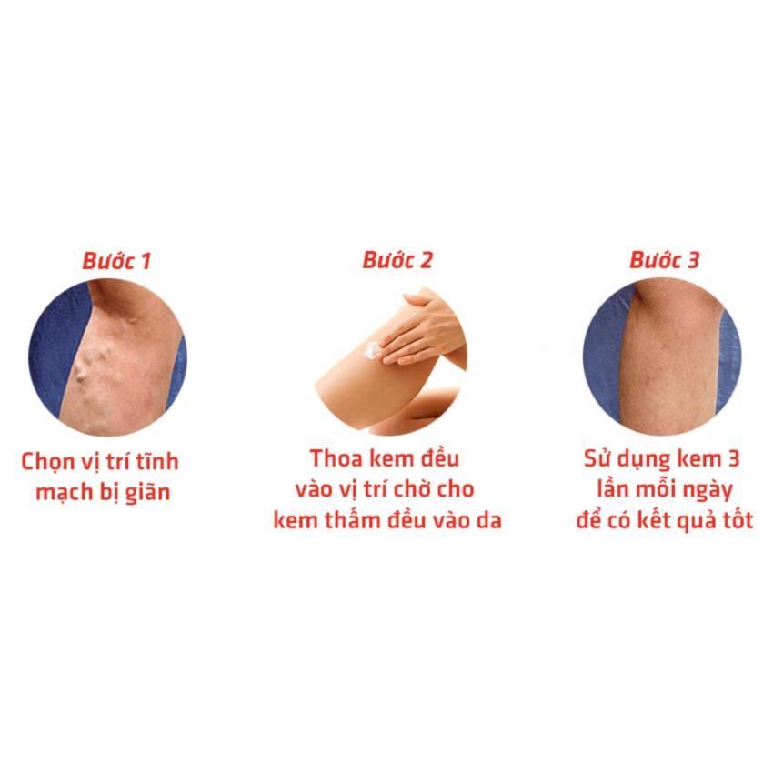 Kem Varikosette điều trị giãn tĩnh mạch 75ml Nga