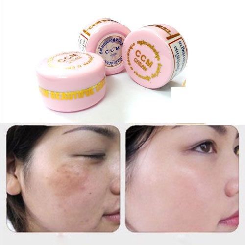 Kem đặc trị nám CCM Cream Thái Lan 10g