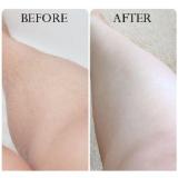 Kem tẩy lông Veet hair remover 100ml