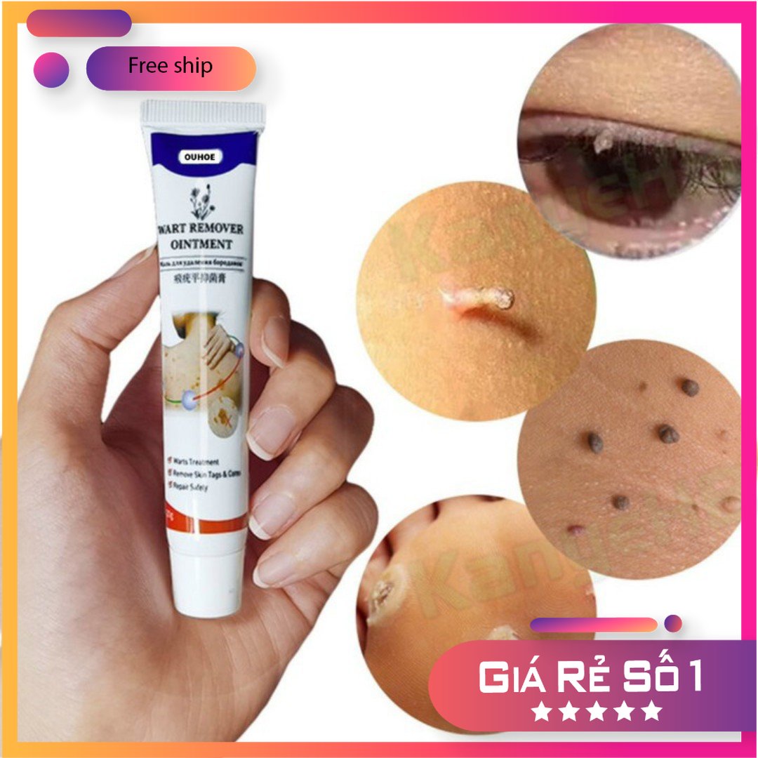 Kem Wart Remover Ouhoe Nội Địa 20g Khử Mụn Cóc Mụn Thịt Nốt Ruồi