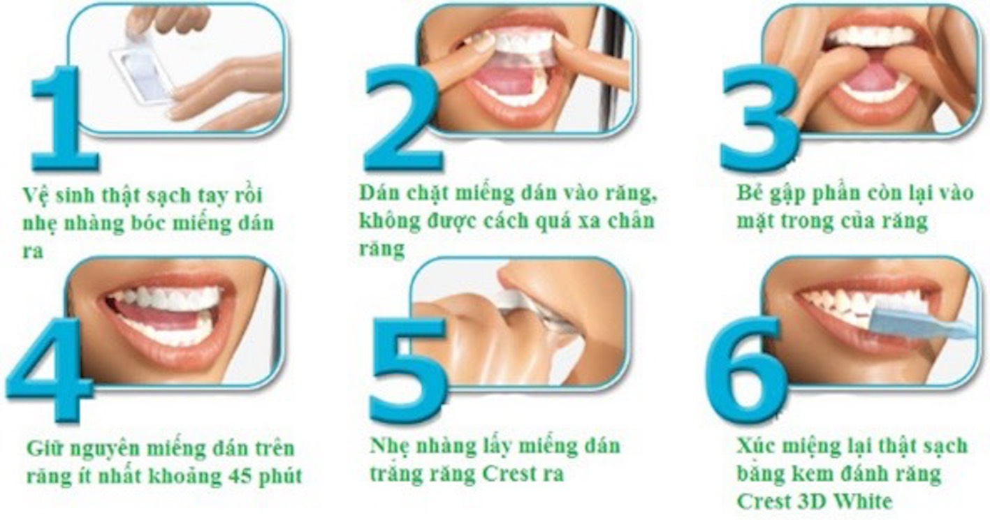 Dán Trắng Răng Crest 4 miếng