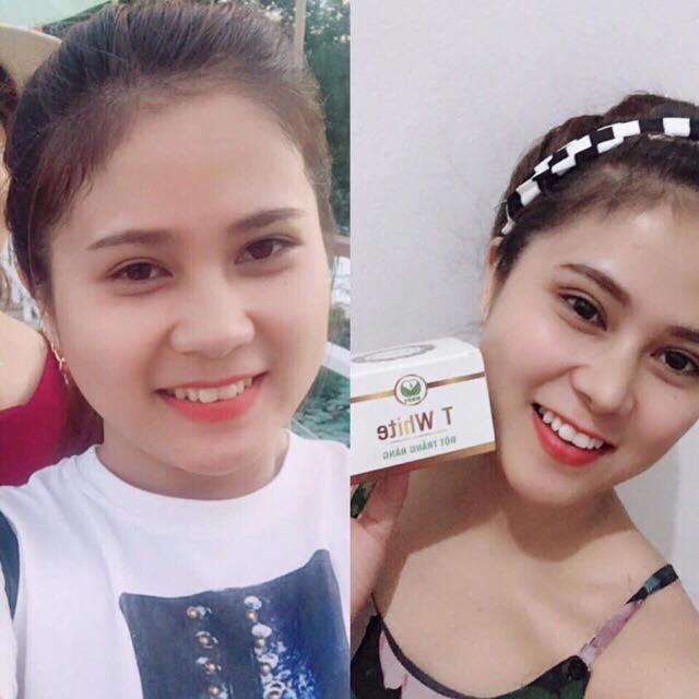 Bột Trắng Răng T White