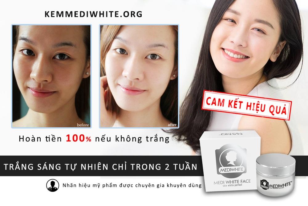 Kem trắng da Medi White Face 25ml