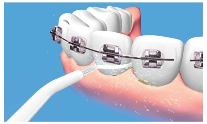 Dụng Cụ Vệ Sinh Răng Miệng