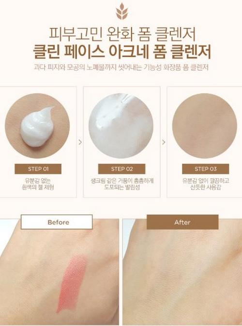 Sữa Rửa Mặt Trị Mụn TheFaceShop Clean Face Acne Solution Foam Cleansing 150ml