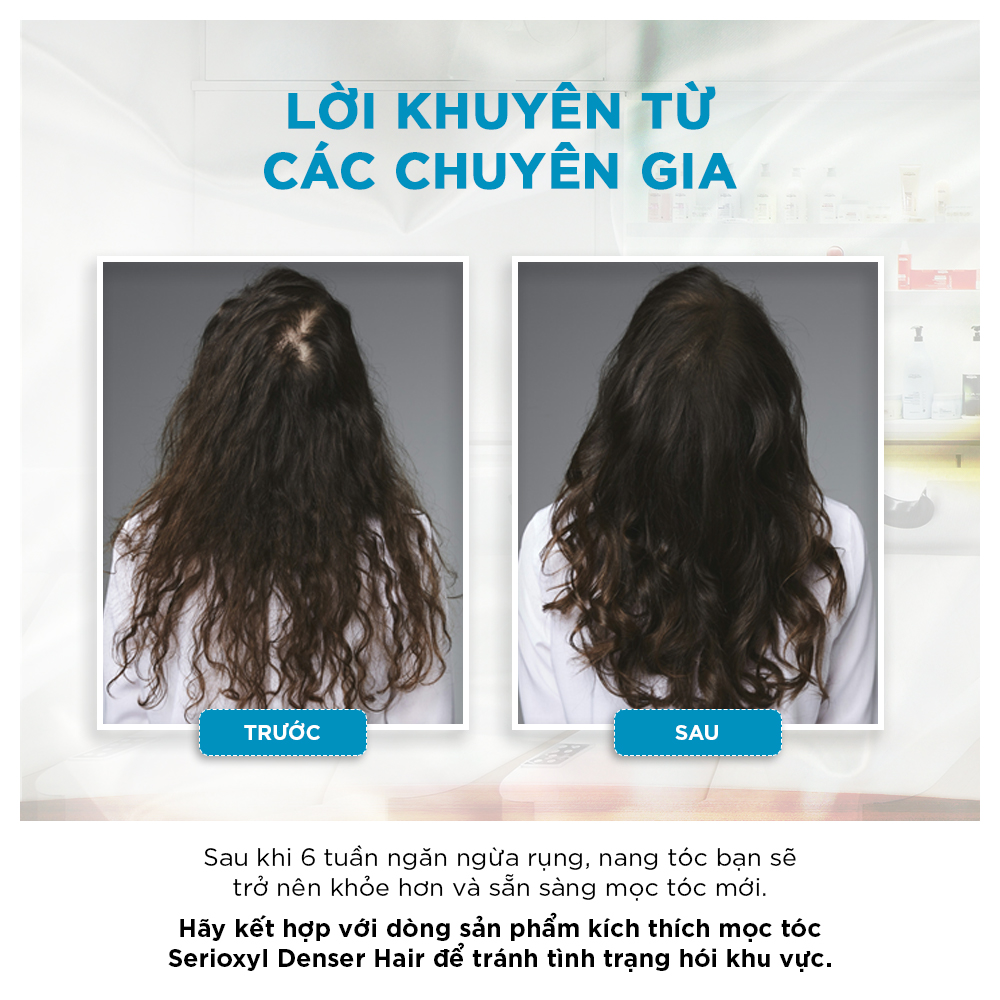 Dầu gội chăm sóc tóc rụng Loreal Density Advanced Omega 500m