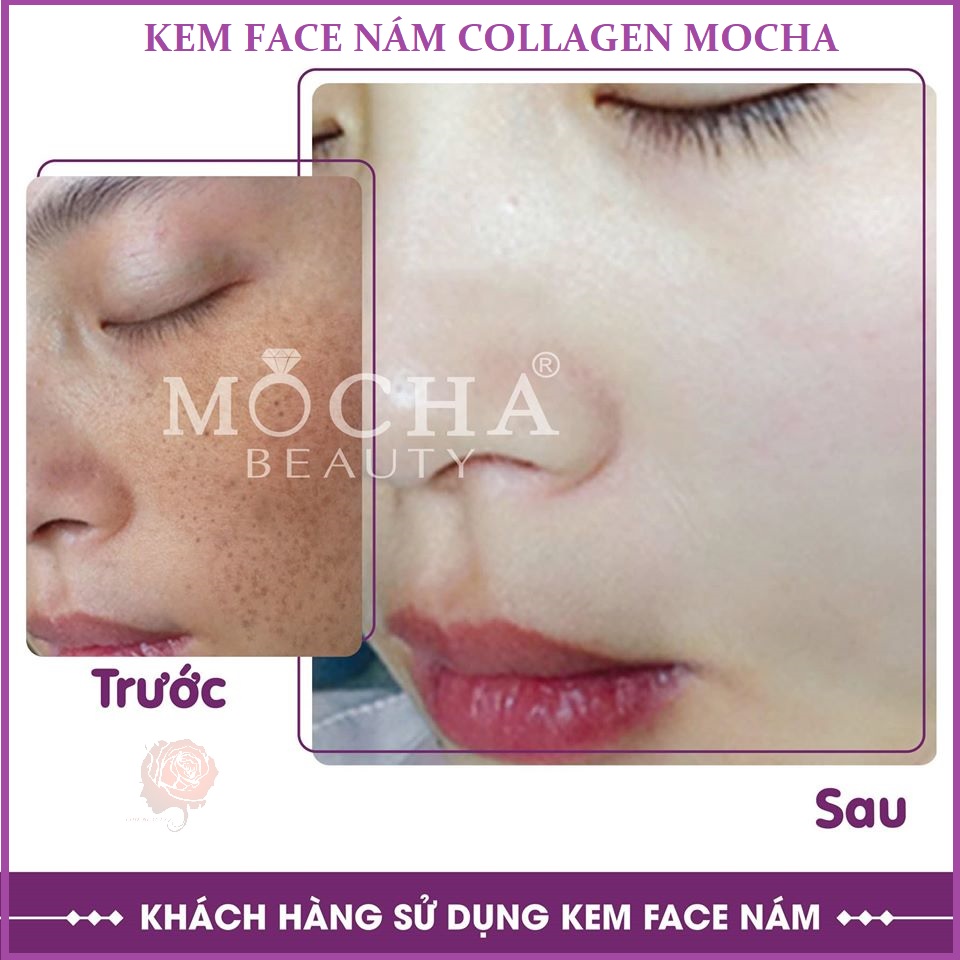 Kem trị nám Face Collagen tảo non Mocha