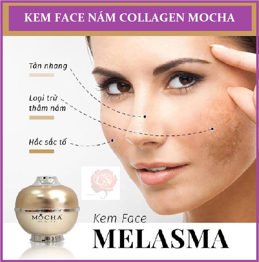 Kem trị nám Face Collagen tảo non Mocha