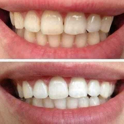 Than Hoạt Tính Trắng Răng SMILE UP - 100gr ( SMU03)