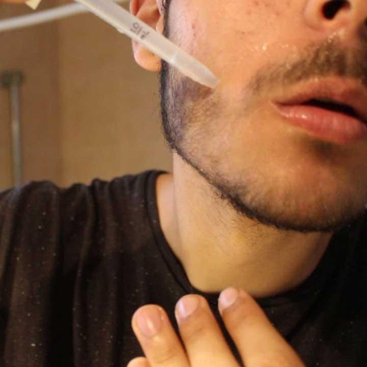 [HCM]Ống hút dung dịch minoxidil 5%