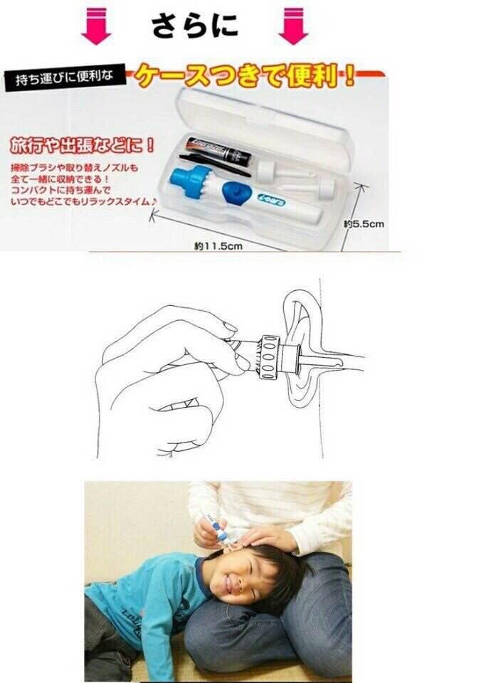 Máy hút ráy tai Nhật Bản DEO Cross i ears