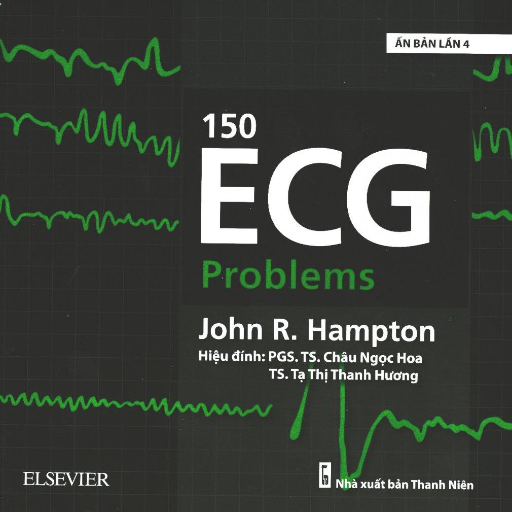 150 ecg problems