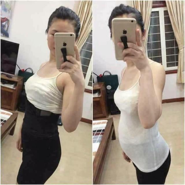 Đai nịt bụng Missbelt giảm eo sau sinh