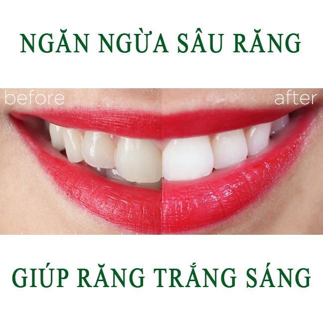 [HCM]Kem đánh răng sensodyne 100g - LOẠI 1