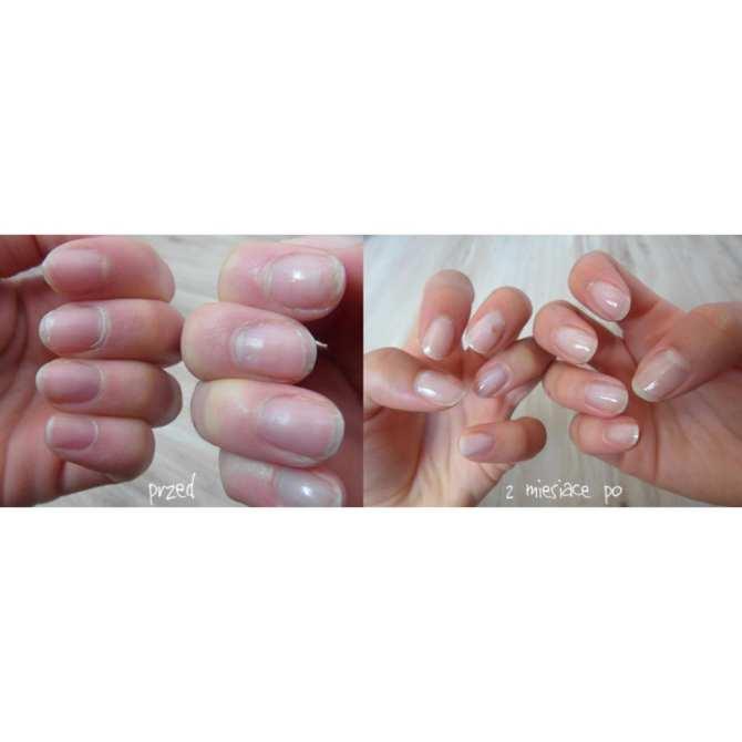 [HCM]Nước Sơn Dưỡng Móng Eveline 8in1 - Nga