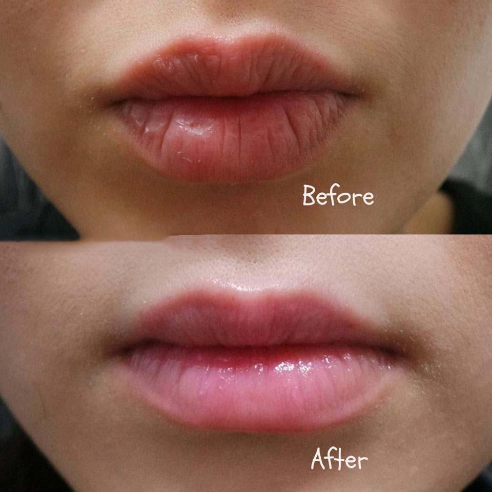 Son Dưỡng DHC Lip Cream Trị Thâm Môi Nhật Bản 1.5g