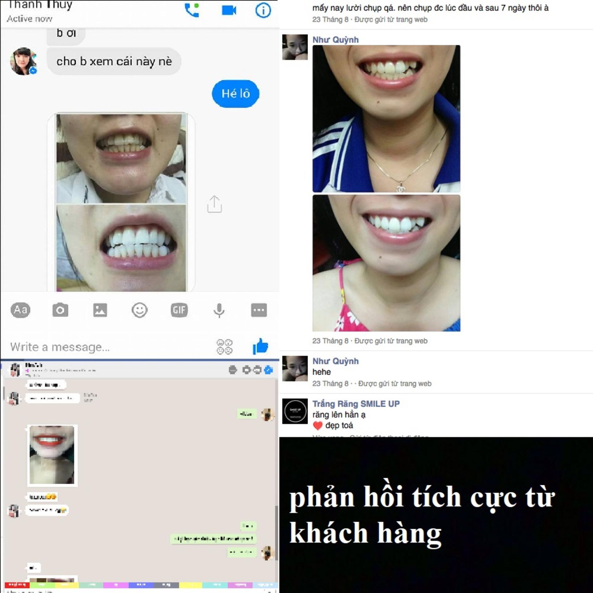 Than hoạt tính trắng răng SMILE UP