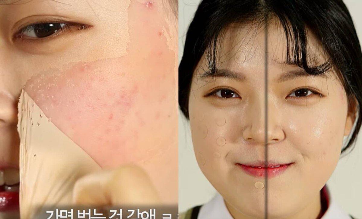 Gel vá da che mụn, sẹo thần thánh Not4U Real Skin Patch