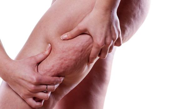 Máy massage vùng da bị celluite ( sần vỏ cam ) Beurer CM50