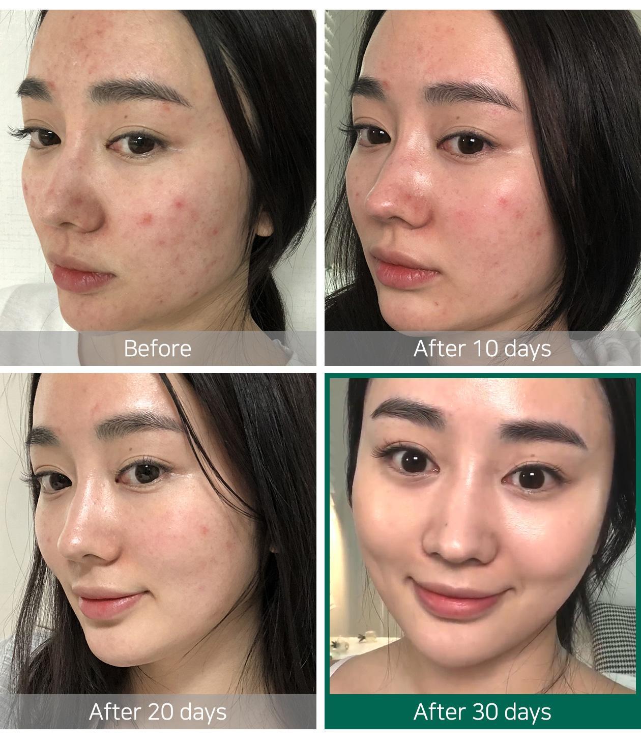 Some By Mi AHA-BHA-PHA 30 Days Miracle Toner 150ml