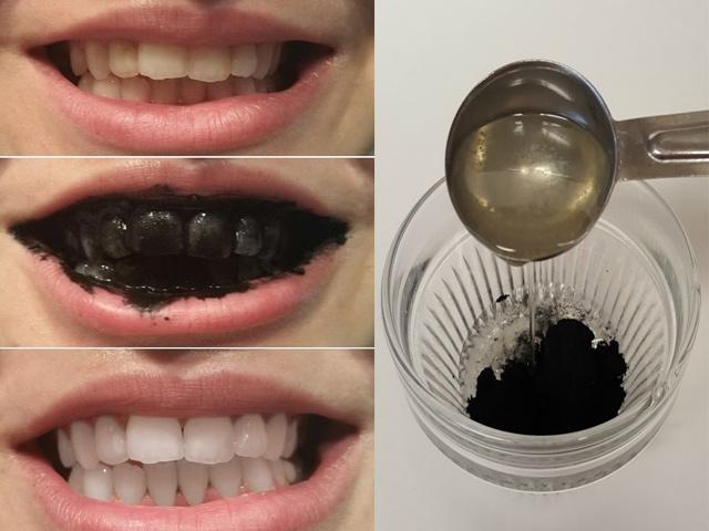 Than Hoạt Tính Trắng Răng SMILE UP