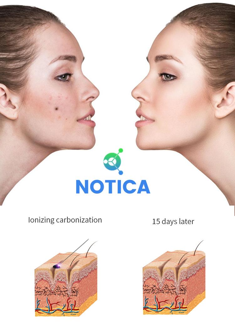 MÁY ĐỐT NỐT RUỒI,MỤN THỊT,XÓA XĂM
