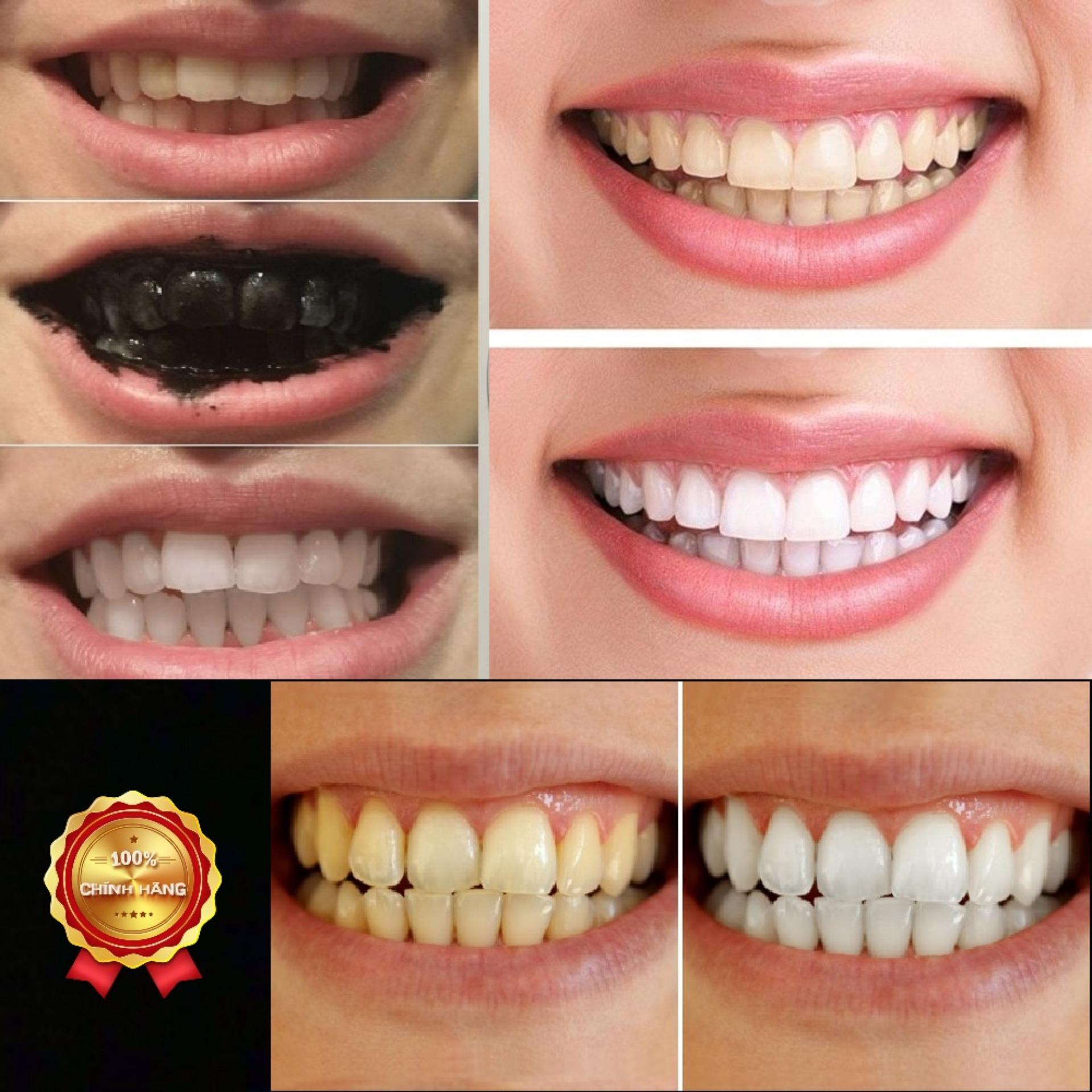 [HCM]Than hoạt tính trắng răng SMILE UP 100gram