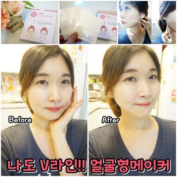 Set 20 Miếng Dán Mặt Vline thần kỳ