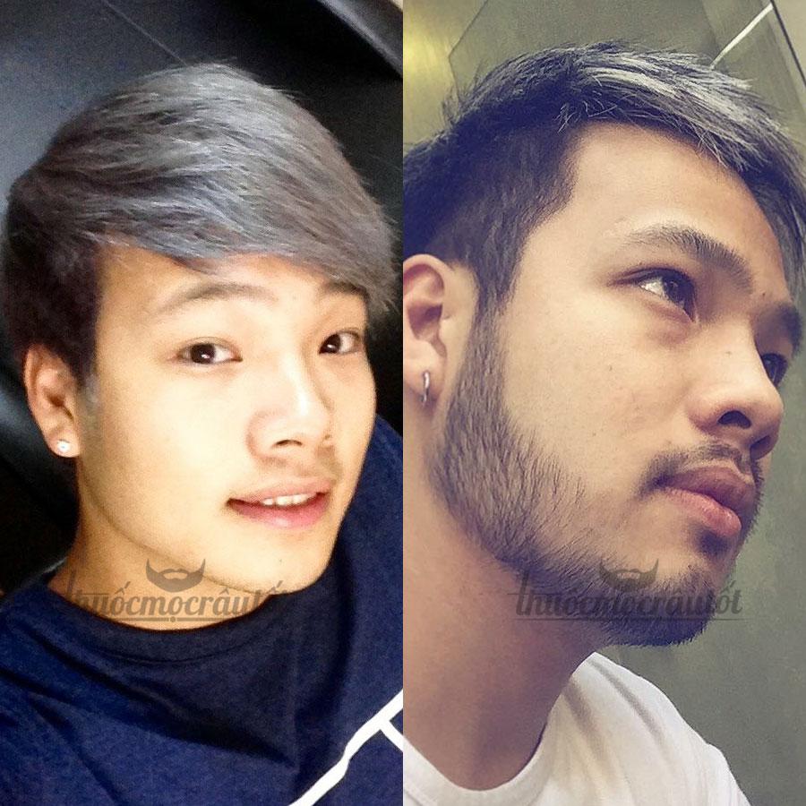 Thuốc mọc râu Kirkland của Mỹ