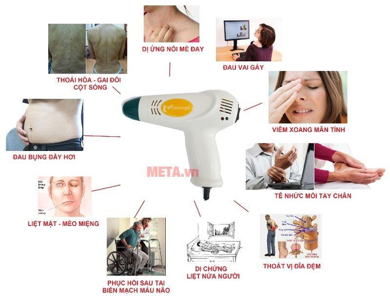 Máy xông cứu ngải Maxonga , Máy cứu ngải Hải Phòng