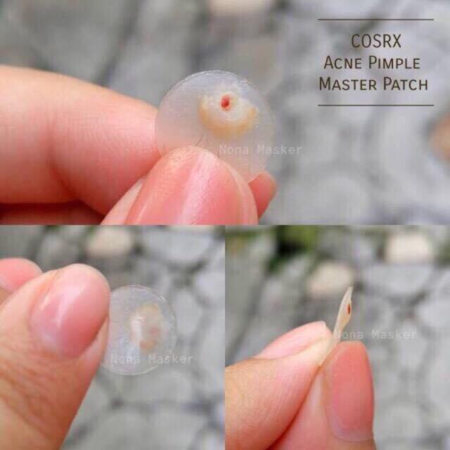 MIẾNG DÁN MỤN COSRX
