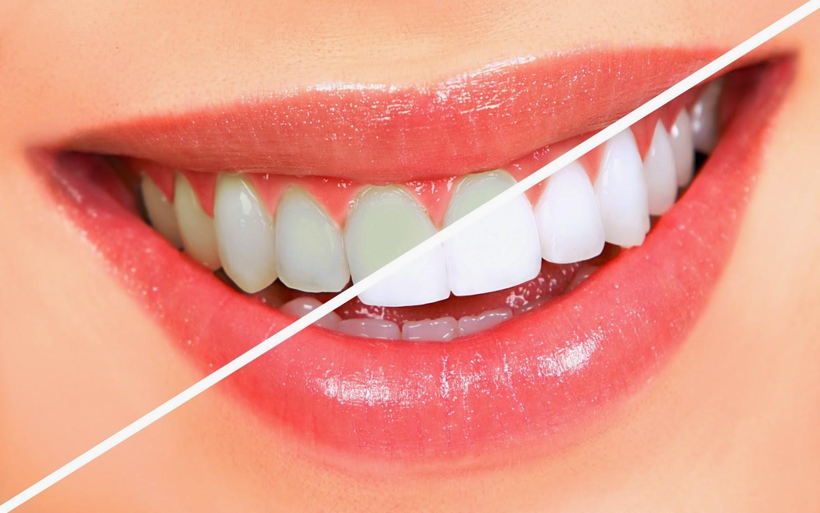Bộ Làm Trắng Răng 1 Bột Và 1 Kem Eucryl Toothpaste