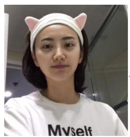 Băng đô tai mèo
