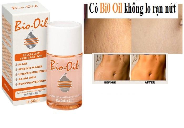 Tinh Dầu Bio Oil Làm Mờ Rạn Nứt Da và Mờ Sẹo 60ml