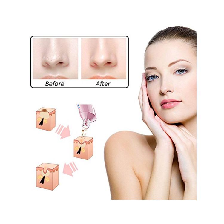 [HCM]Máy hút mụn cầm tay Goodsky X5 công nghệ Hàn Quốc