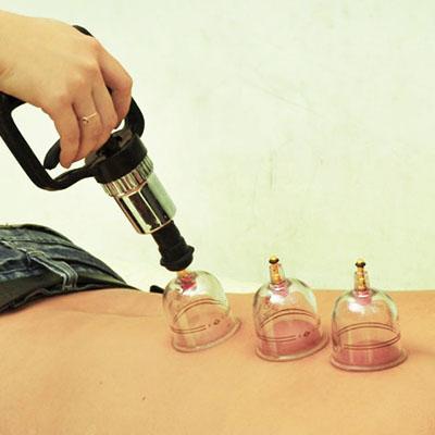 Giác hơi không dùng lửa Duy Thành vali đen - 15 ống giác