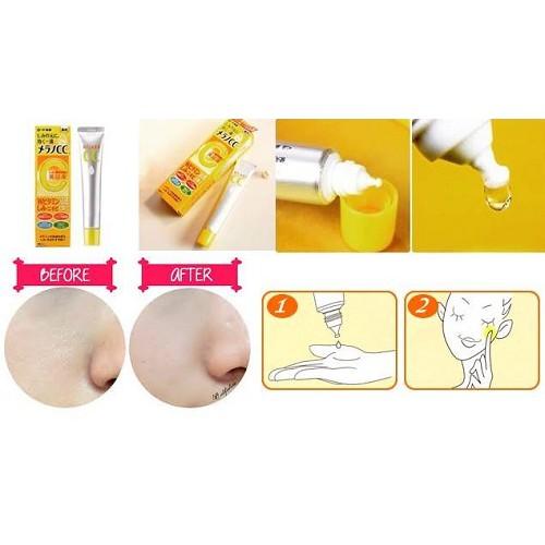 Serum trị thâm nám Melano CC Nhật 20ml