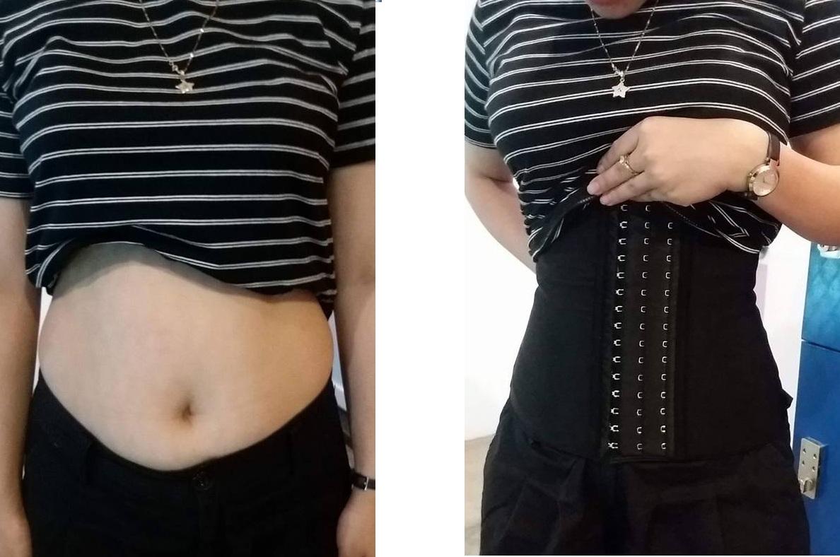 Đai Gen Bụng Định Hình Giảm cân cao cấp Latex