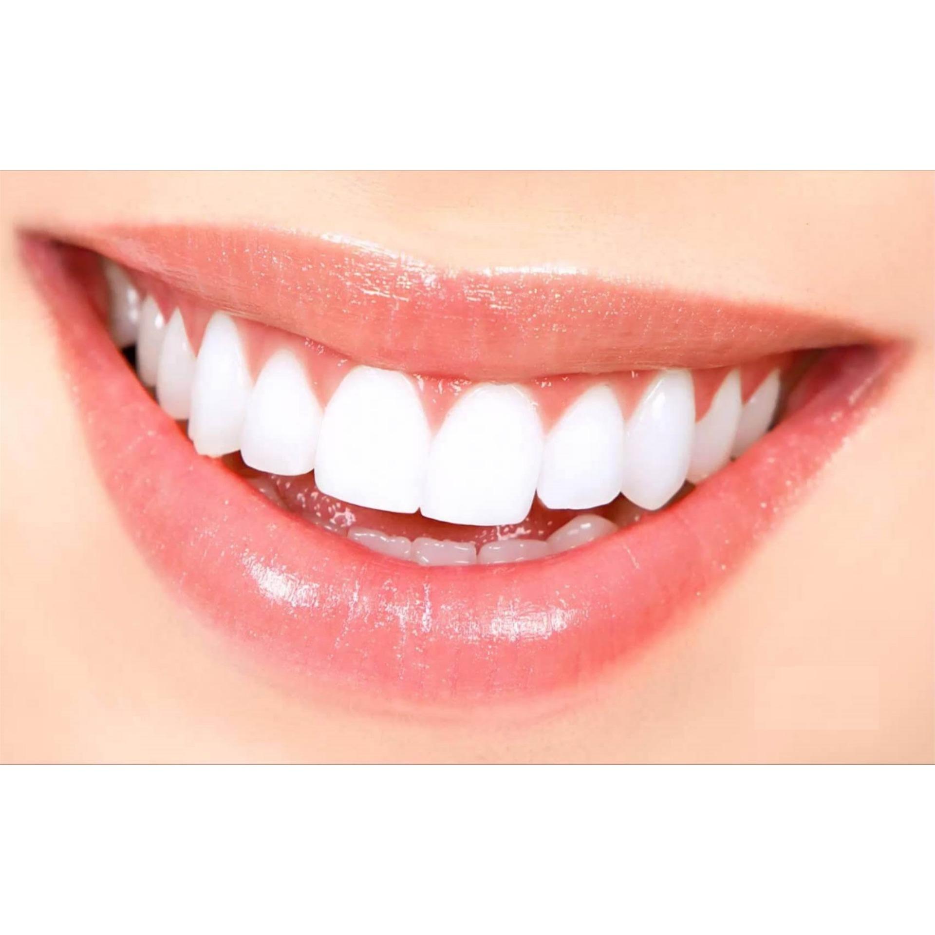 Kem đánh răng Colgate Mỹ Total Whitening 181g