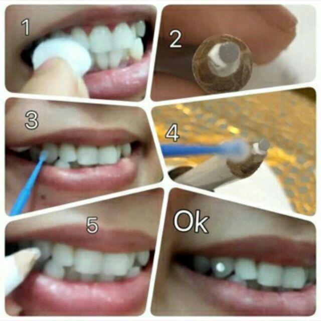 Bộ đá đính răng kèm keo và bút