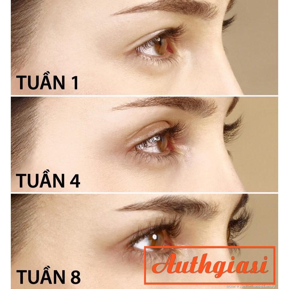 Dưỡng dài mi Careprost Ấn Độ