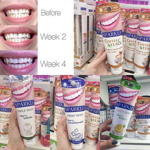 Kem đánh răng siêu trăng SPARKLE 100g Thái Lan