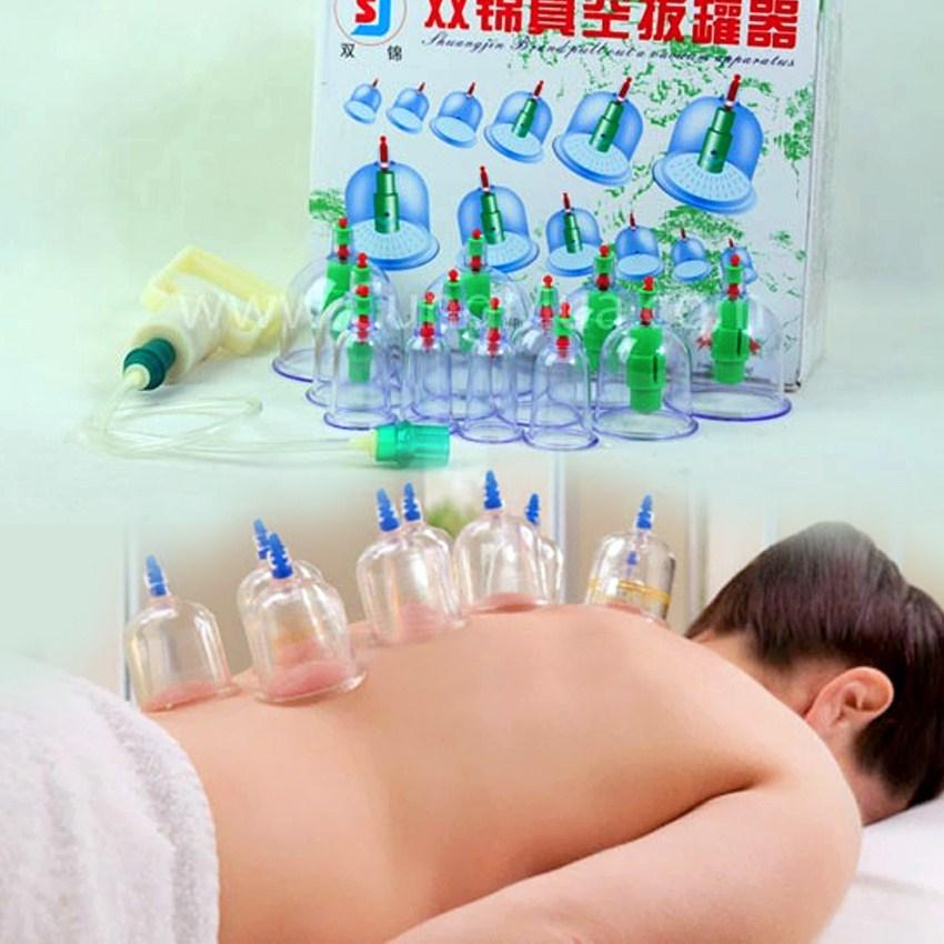 Bộ giác hơi 12 ống hút chân không