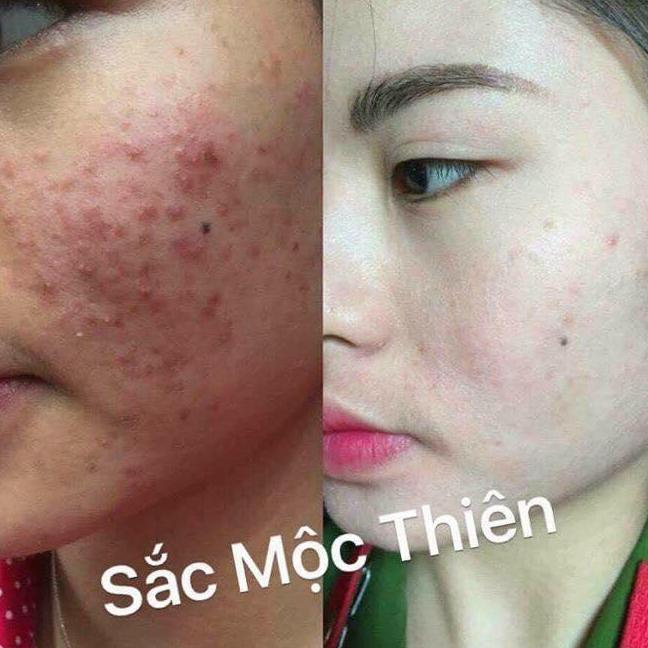 Sắc mộc thiên