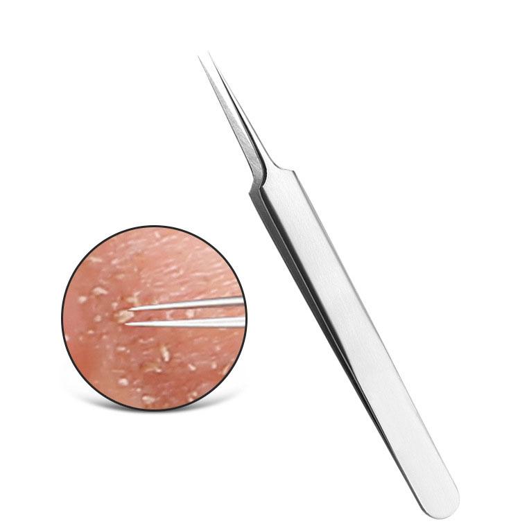 Combo 2 Nhíp Gắp Mụn Đầu Đen, Mụn Dưới Da Thông Minh