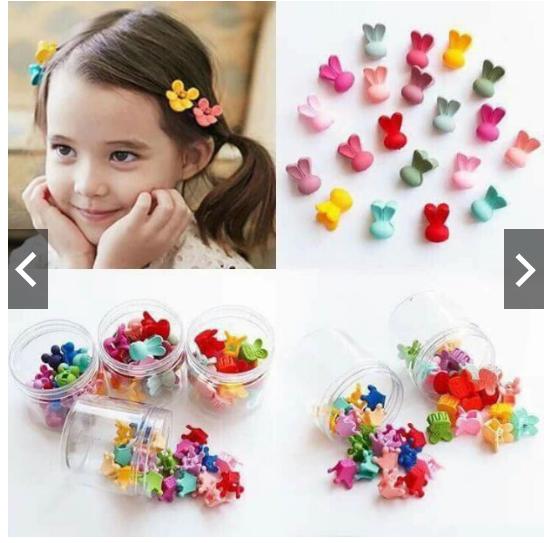 hộp 25 kẹp tóc cho bé yêu cực xinh