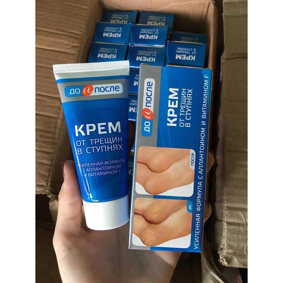 TRỊ NỨT GÓT CHÂN KPEM 150 ML