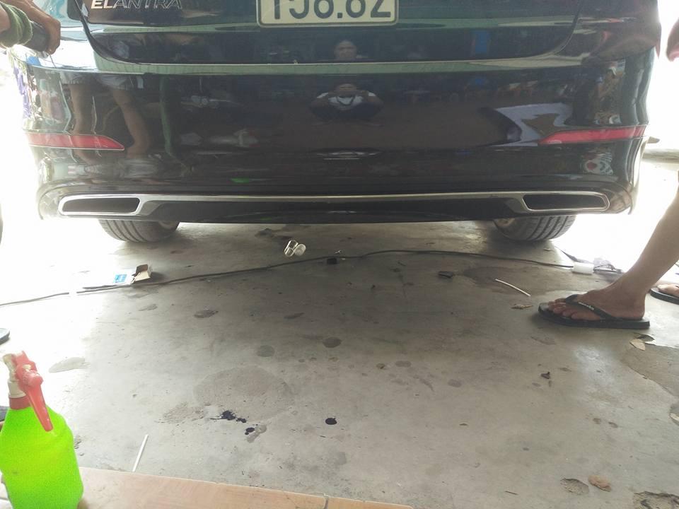 Lip chia bô elentra 2016-2017-2018mẫu Mercedes E250
