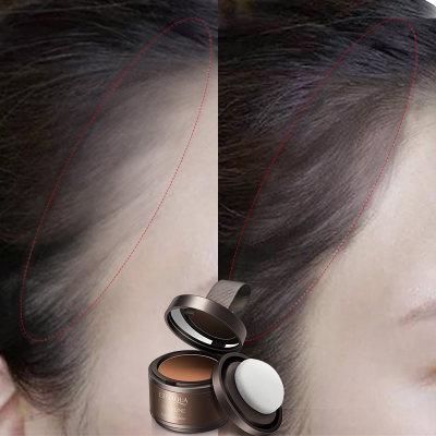 Phấn che khuyết điểm phần chân tóc Bioaqua