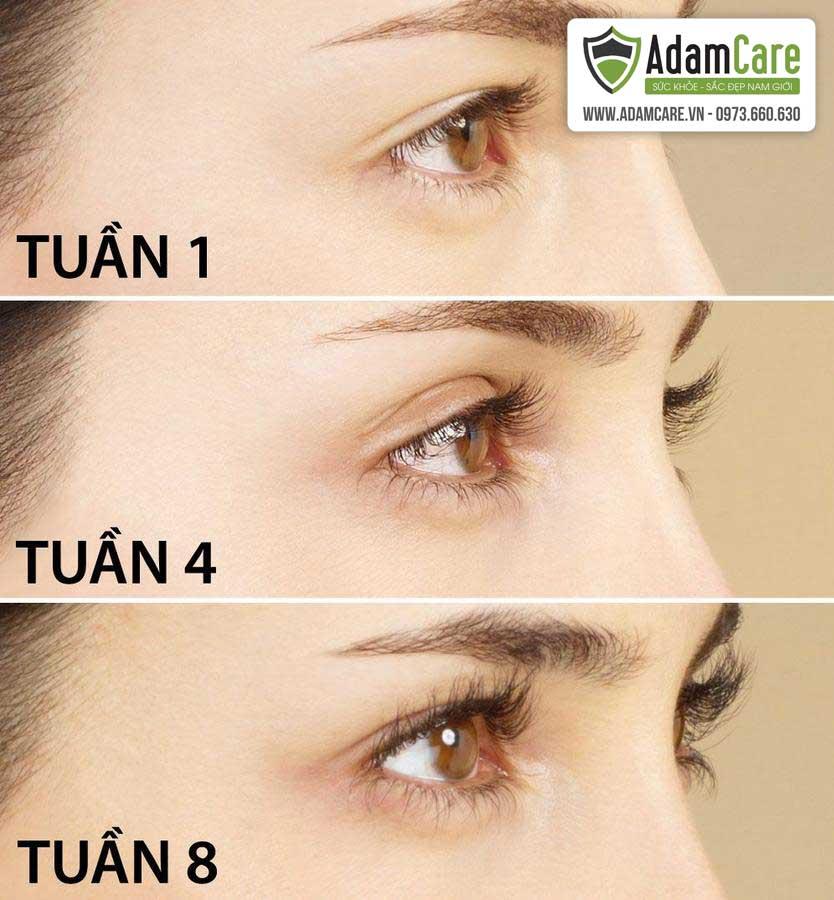 Serum kích mọc lông mi dài